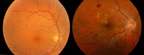 Optometrist Response to Atlantic’s Article on The Eye Exam “Scam”